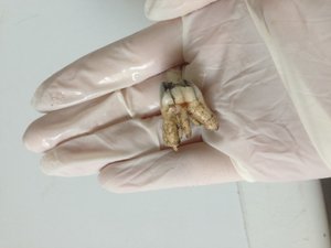 Zahn3 (Small).jpg Zahn3 (Small).jpg