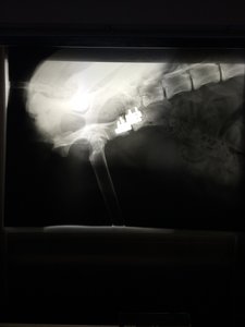 Abby RÃ¶ntgen1.jpg