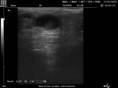 Flash Blase längs 1.JPG