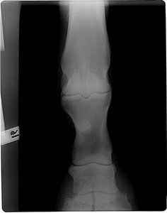 Manuel Hufbeinfraktur004-800x600.jpg