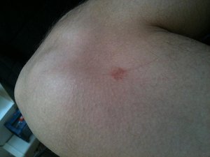 IMG_0174.JPG IMG_0174.JPG